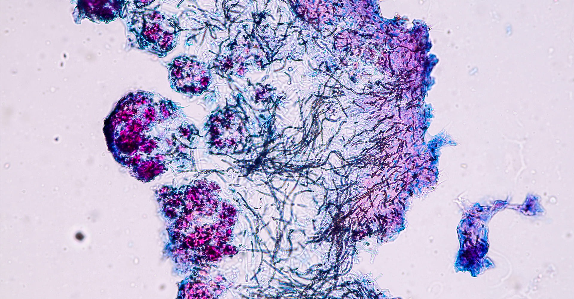 Zoom macro sur du lichen, des hyphes et des algues symbiotiques au microscope dans des teintes violettes